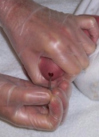 procedimiento_recogida_muestras/fenilcetonuria_prueba_talon procedimiento_recogida_muestras/fenilcetonuria_prueba_talon