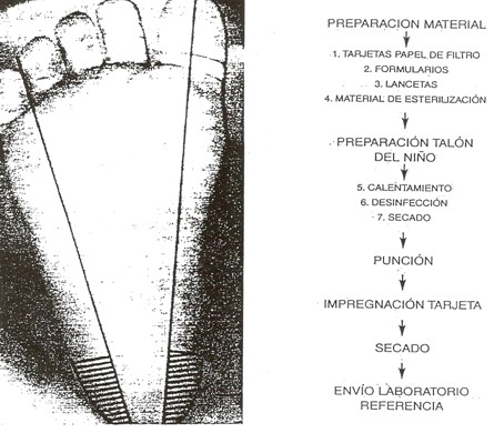 procedimiento_recogida_muestras/prueba_puncion_talon procedimiento_recogida_muestras/prueba_puncion_talon