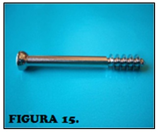 tornillos_quirurgicos_enfermeria/figura_tornillo_esponjoso