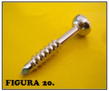 tornillos_quirurgicos_enfermeria/figura_tornillo_sindesmotico