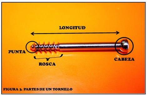 tornillos_quirurgicos_enfermeria/partes_del_tornillo