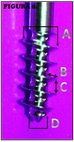 tornillos_quirurgicos_enfermeria/perfil_de_rosca