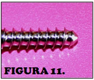 tornillos_quirurgicos_enfermeria/punta_tornillo_estandar tornillos_quirurgicos_enfermeria/punta_tornillo_estandar