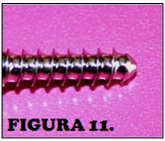 tornillos_quirurgicos_enfermeria/punta_tornillo_estandar