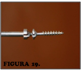 tornillos_quirurgicos_enfermeria/tornillo_click_off