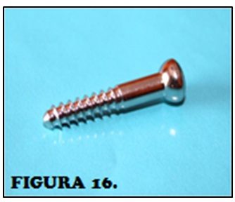 tornillos_quirurgicos_enfermeria/tornillo_de_compresion