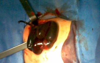 volvulo_necrosis_intestino/asas_delgado_necrosadas volvulo_necrosis_intestino/asas_delgado_necrosadas