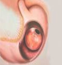 balon_intragastrico_gastrico/obesidad_sobrepeso_adelgazar balon_intragastrico_gastrico/obesidad_sobrepeso_adelgazar