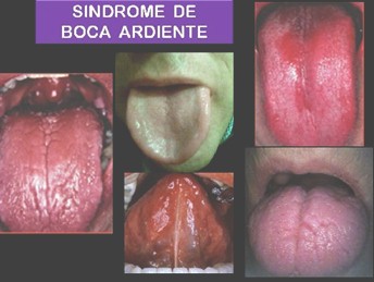 sindrome_boca_ardiente/caso_clinico_imagen
