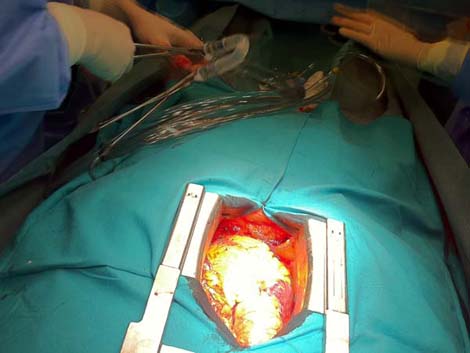cirugia_twitter_cardiaca/008 cirugia_twitter_cardiaca/008