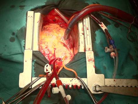 cirugia_twitter_cardiaca/010 cirugia_twitter_cardiaca/010