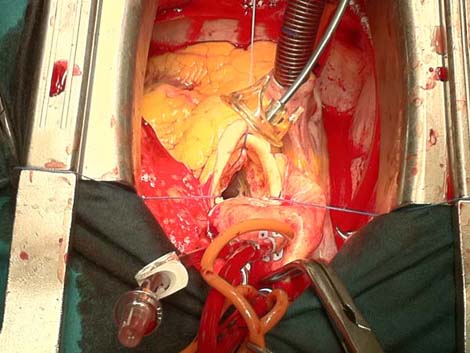 cirugia_twitter_cardiaca/015 cirugia_twitter_cardiaca/015