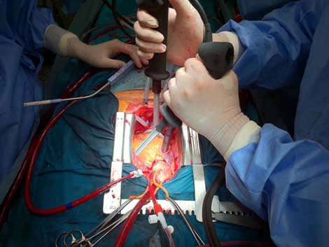 cirugia_twitter_cardiaca/022 cirugia_twitter_cardiaca/022