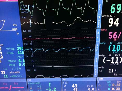 cirugia_twitter_cardiaca/023 cirugia_twitter_cardiaca/023