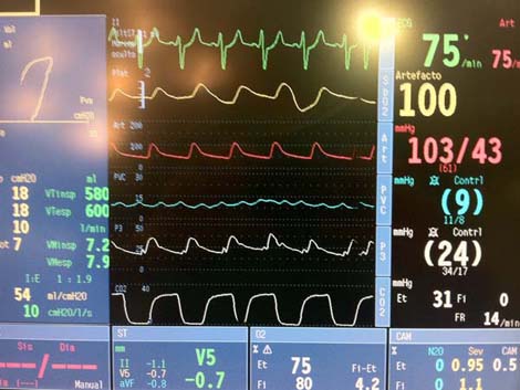 cirugia_twitter_cardiaca/024 cirugia_twitter_cardiaca/024