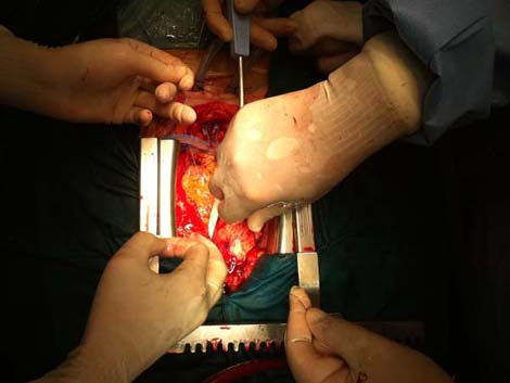 cirugia_twitter_cardiaca/025 cirugia_twitter_cardiaca/025