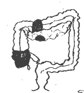 trombosis_mesenterica_lupus/anatomia_intestino_grueso