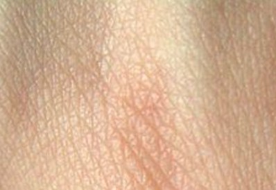 piel_estructura_funciones/dermis_hipodermis_epidermis piel_estructura_funciones/dermis_hipodermis_epidermis
