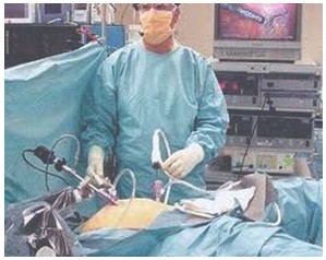 apendicectomia_laparoscopica_cirugia/posicion_tres_trocanteres