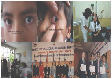 diagnostico_conjuntivitis_alergica/fotos_conjuntivitis_alergica diagnostico_conjuntivitis_alergica/fotos_conjuntivitis_alergica