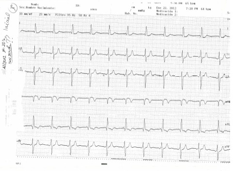 enfermedad_coronaria_ECG/ECG_1_ingreso_1 enfermedad_coronaria_ECG/ECG_1_ingreso_1
