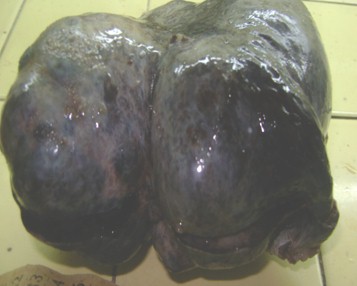 tumor_caso_Brenner/extirpado_anatomia_patologica tumor_caso_Brenner/extirpado_anatomia_patologica