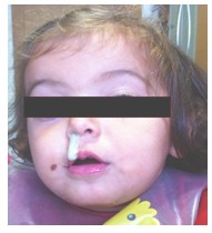 cuerpo_ORL_nasal/cuerpo_nasal cuerpo_ORL_nasal/cuerpo_nasal