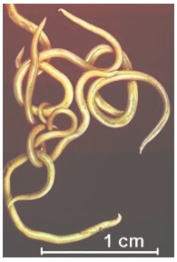 enfermedades_infecciosas_helmintos/imagen_de_anisakis enfermedades_infecciosas_helmintos/imagen_de_anisakis