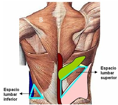 hernia_lumbar_grasa/espacio_lumbar_superior_Grynfeld