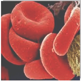 interpretacion_parametros_sanguineos/imagen_hematies_eritrocitos interpretacion_parametros_sanguineos/imagen_hematies_eritrocitos