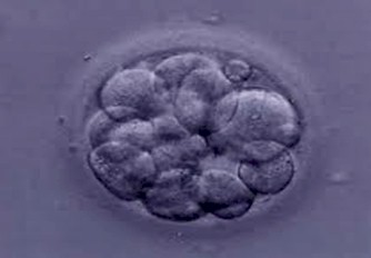 medicina_celulas_madre/totipotentes_totipotente_embrionarias medicina_celulas_madre/totipotentes_totipotente_embrionarias