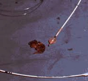 oclusion_arterial_aguda/Fogarty_embolia_embolectomia
