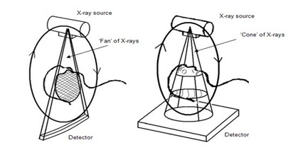 TAC_haz_conico/cone_beam_tomography