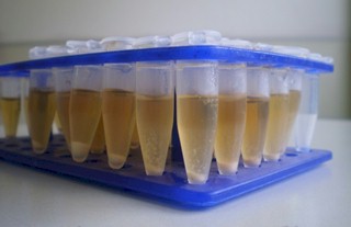 biofilm_virulencia_levaduras/cultivo_caldo_Saboraud