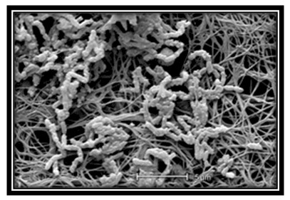 germenes_dialisis_peritoneal/bacteria_Achromobacter_xylosoxidans