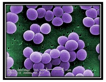 germenes_dialisis_peritoneal/bacteria_Estafilococo_genero
