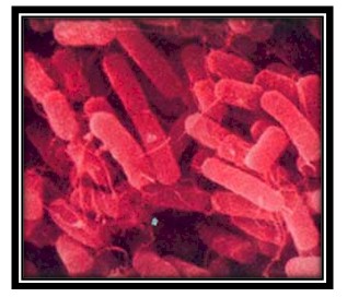 germenes_dialisis_peritoneal/bacteria_Klebsiella_pneumoniae