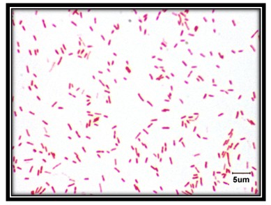 germenes_dialisis_peritoneal/bacteria_Proteus_mirabilis