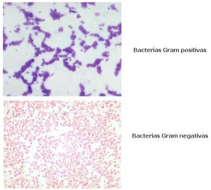 germenes_dialisis_peritoneal/bacterias_grampositivas_gramnegativas