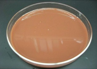 germenes_dialisis_peritoneal/cultivo_agar_chocolate