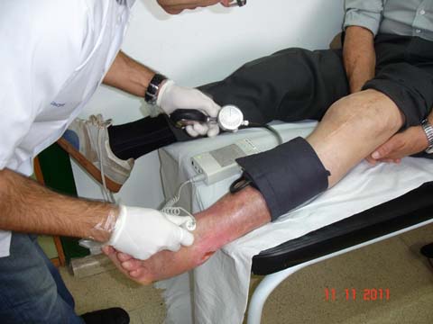 sindrome_Klinefelter_ulceras/indice_tobillo_brazo