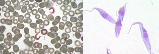 diagnostico_enfermedad_chagas/tripomastigote_tripanosoma_cruzi diagnostico_enfermedad_chagas/tripomastigote_tripanosoma_cruzi