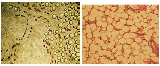 adipocito_tejido_adiposo/vision_microscopio_adipogenesis