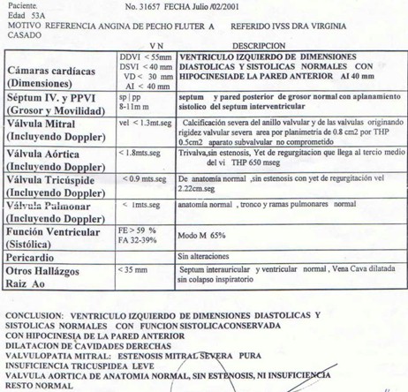 caso_estenosis_mitral/eco_ecocardiograma_ecocardiografia