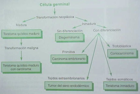 tumores_ovario_tumor/celula_germinal_ovaricos