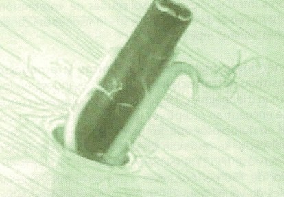 beta_amiloide_peptido/paquetes_vasculo_nerviosos beta_amiloide_peptido/paquetes_vasculo_nerviosos