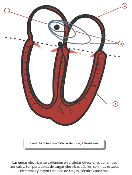 pruebas_origen_tumoral/ondas_electricas_auriculares