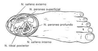 cirugia_pie_diabetico/infiltracion_nervios_pie