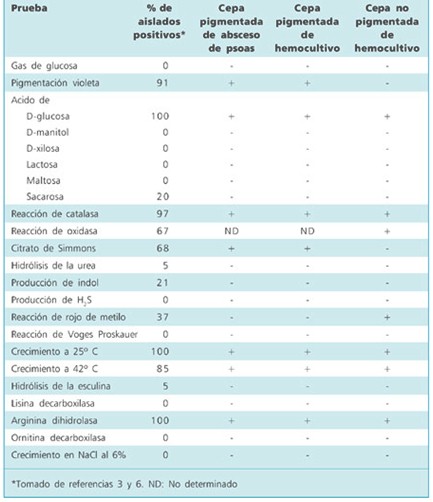 sepsis_Chromobacterium_violaceum/crecimiento_caracteristicas_bioquimicas sepsis_Chromobacterium_violaceum/crecimiento_caracteristicas_bioquimicas