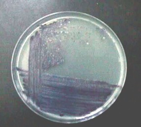sepsis_Chromobacterium_violaceum/hemocultivo_subcultivo_agar